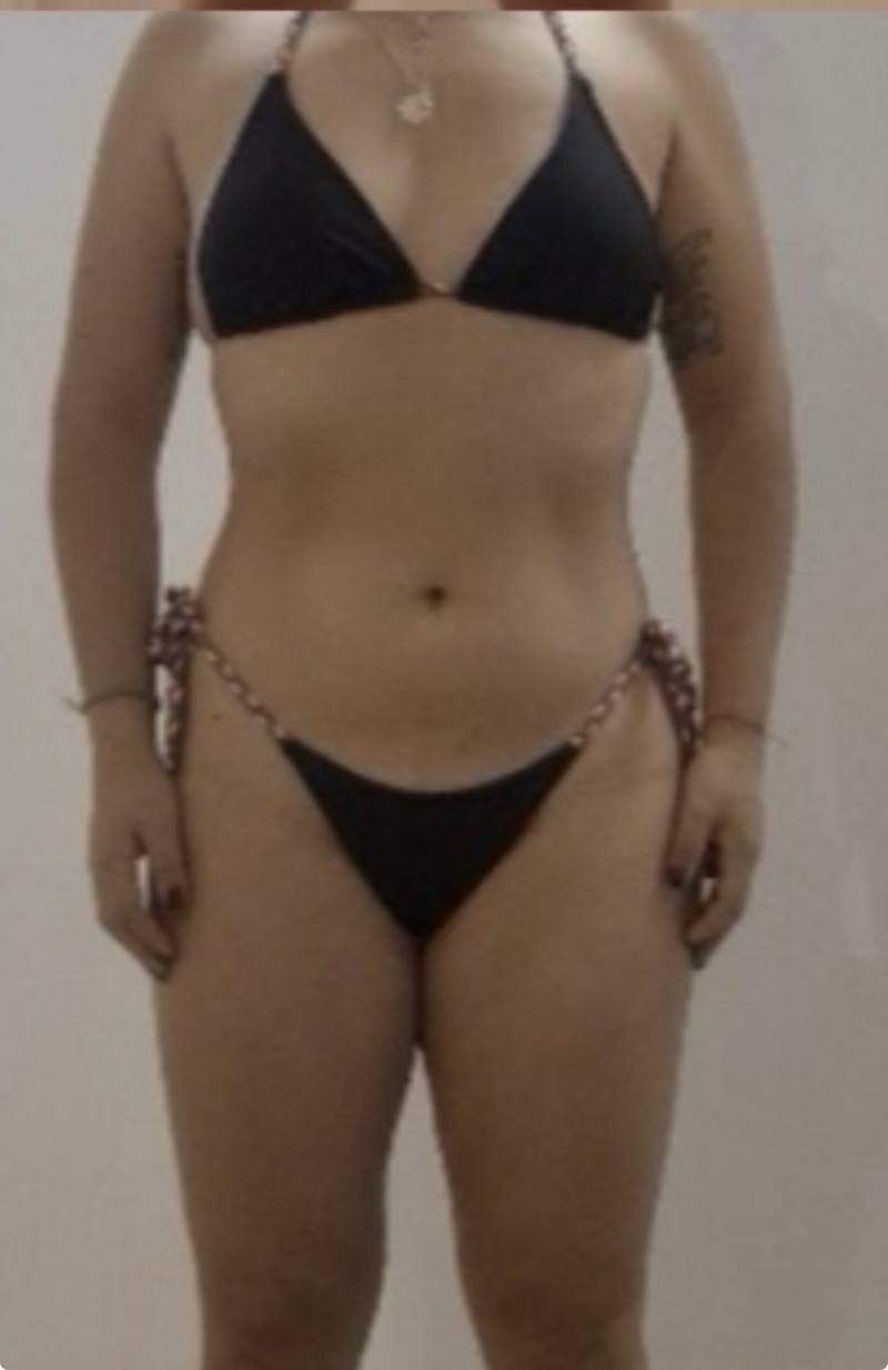 Doly después